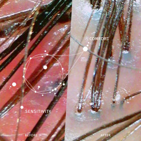 Ritual for sensible scalp | Miriam Quevedo