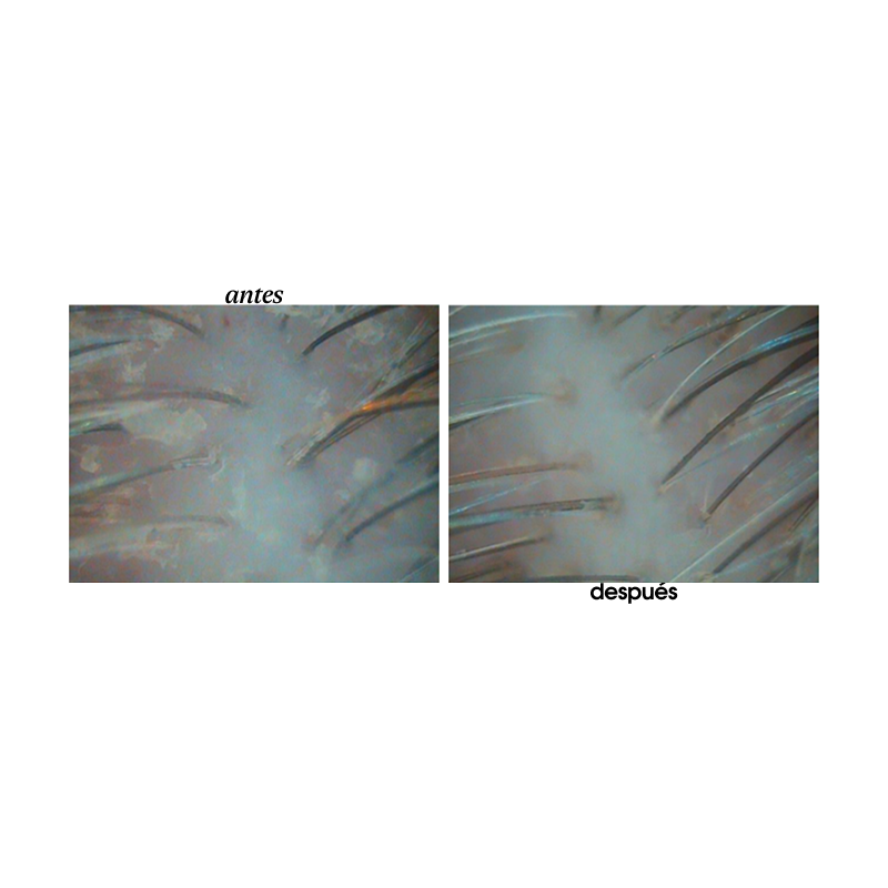 Hair scrub - Miriam Quevedo