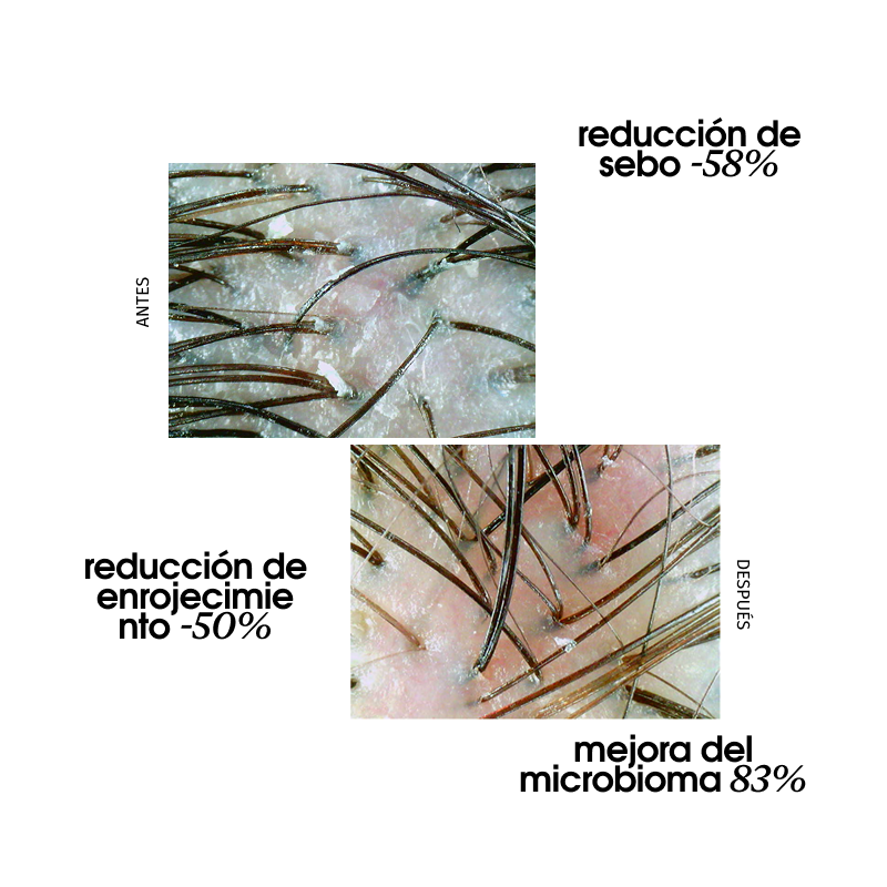 Hair scrub - Miriam Quevedo