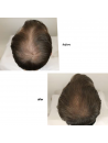 EXTREME CAVIAR REVITALIZING EXOSOMICSHOT SCALP CONCENTRATE