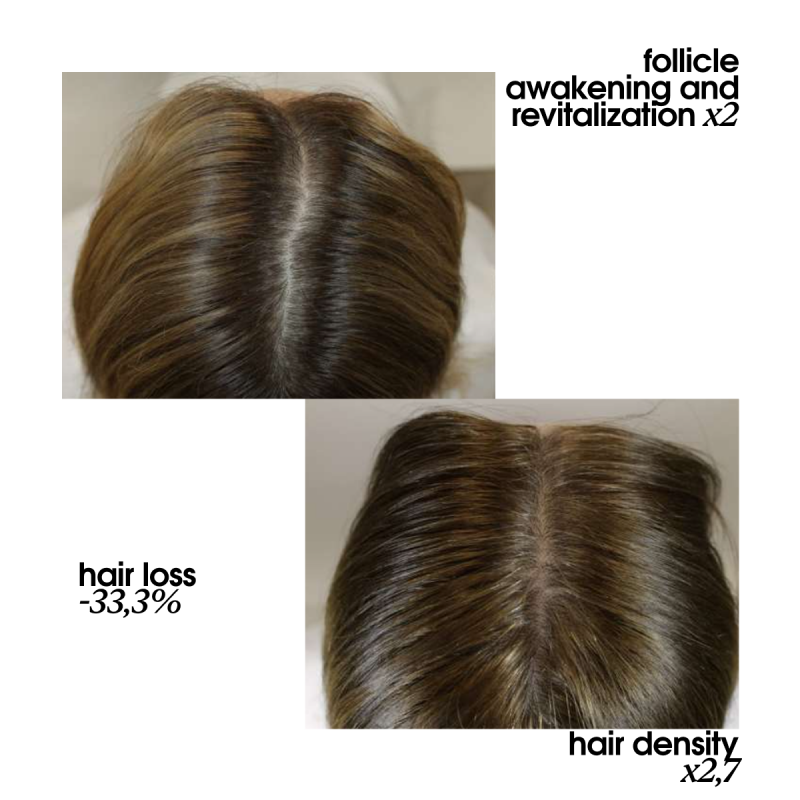 EXTREME CAVIAR REVITALIZING EXOSOMICSHOT SCALP CONCENTRATE