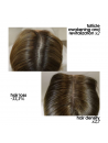 EXTREME CAVIAR REVITALIZING EXOSOMICSHOT SCALP CONCENTRATE