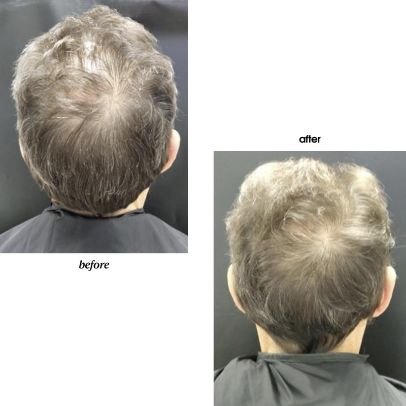 BLACK BACCARA HAIR MULTIPLYING RENEWAL SCALP PEELING
