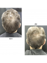 BLACK BACCARA HAIR MULTIPLYING RENEWAL SCALP PEELING
