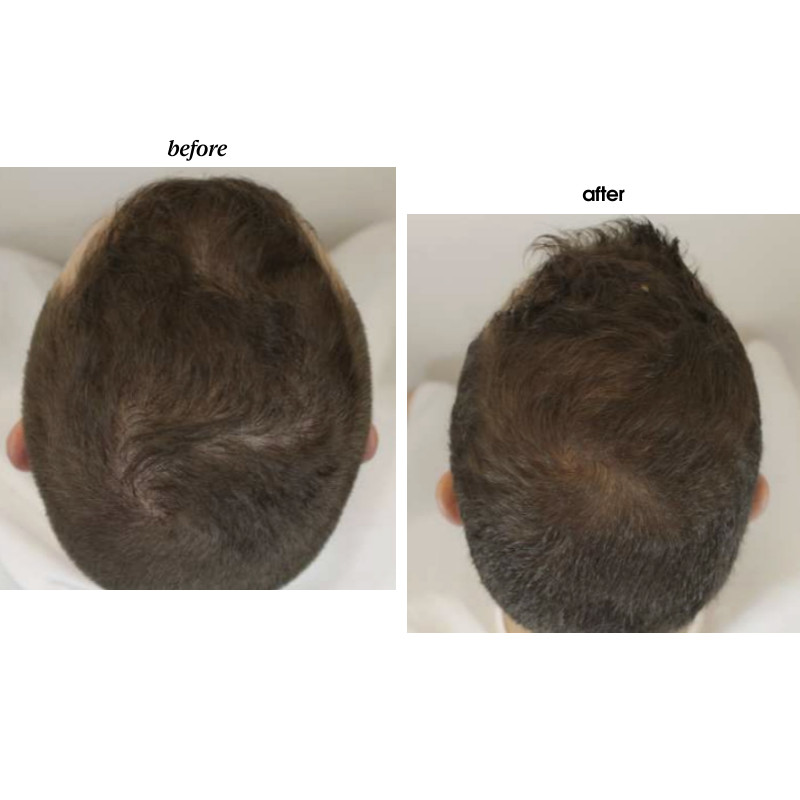 Ritual para combatir la caída del cabello Extreme Caviar