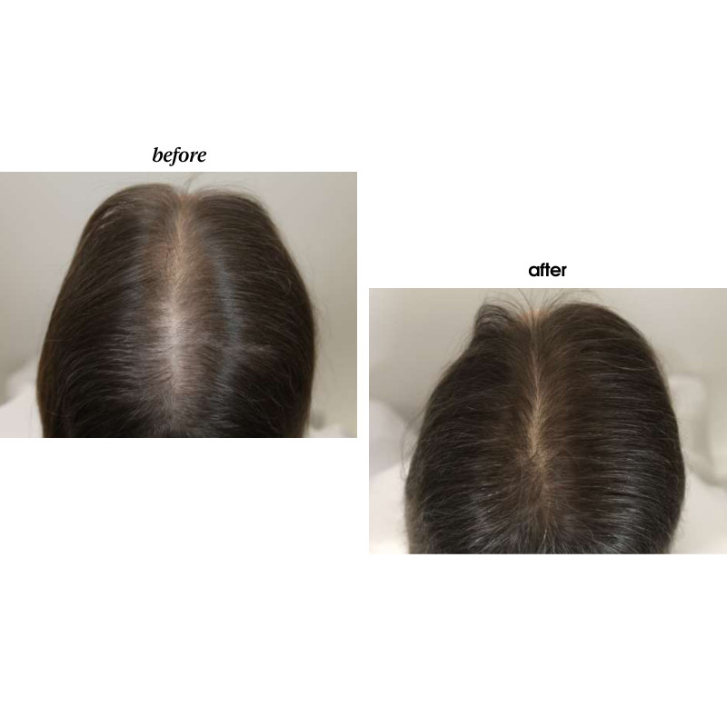 Ritual para combatir la caída del cabello Extreme Caviar