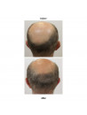 Intensive hair ritual for growth - Miriam Quevedo