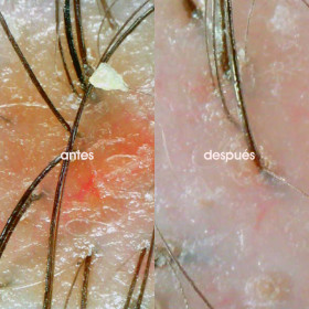 Hair scrub - Miriam Quevedo