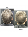 BLACK BACCARA HAIR MULTIPLYING RENEWAL SCALP PEELING