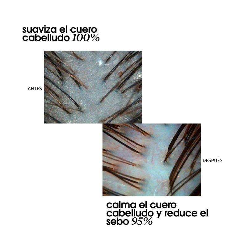 BLACK BACCARA HAIR MULTIPLYING RENEWAL SCALP PEELING