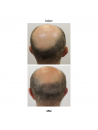 BLACK BACCARA HAIR MULTIPLYING GROWSHOT SCALP CONCENTRATE